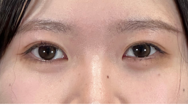 Postoperative Condition Part 1