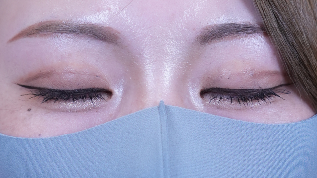 Postoperative Condition Part 1