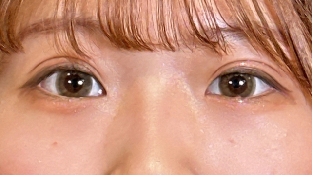 Postoperative Condition Part 1