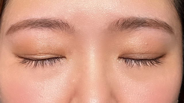 Postoperative Condition Part 1