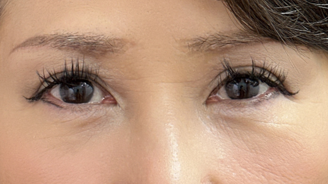 Postoperative Condition Part 1