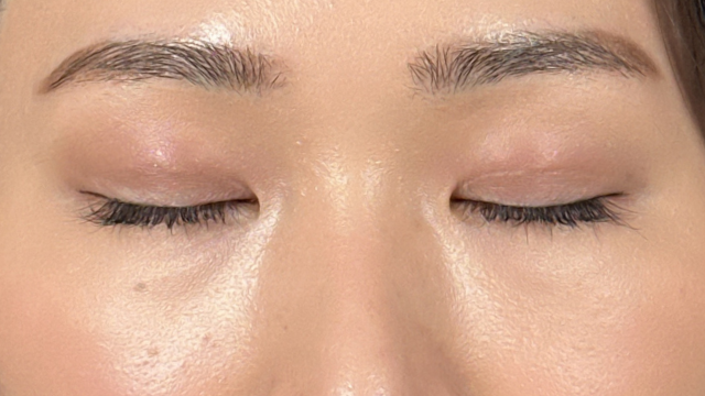 Postoperative Condition Part 1