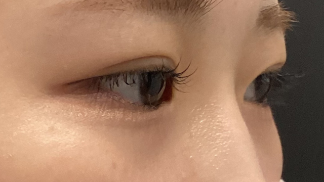 Postoperative Condition Part 1