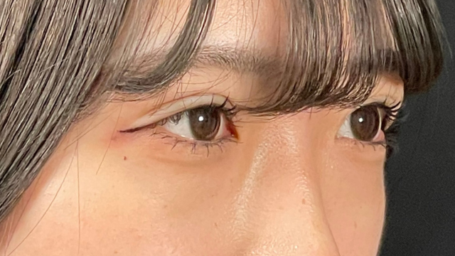 Postoperative Condition Part 1