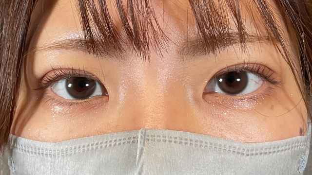 Postoperative Condition Part 1