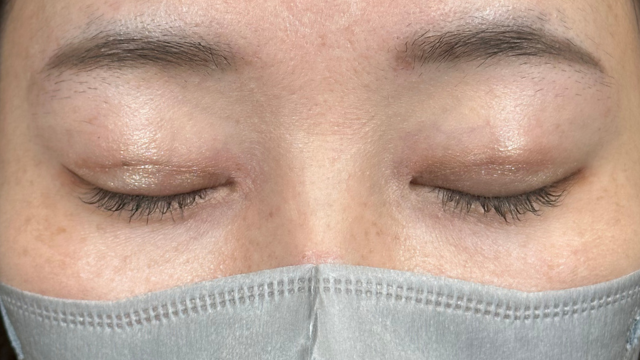 Postoperative Condition Part 1