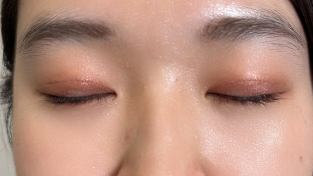 Postoperative Condition Part 1