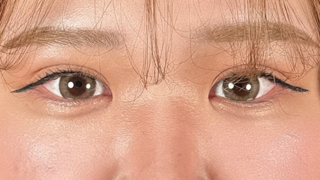 Postoperative Condition Part 1