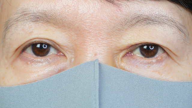 Postoperative Condition Part 1