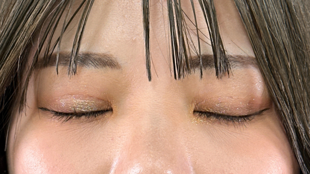 Postoperative Condition Part 1