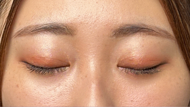 Postoperative Condition Part 1