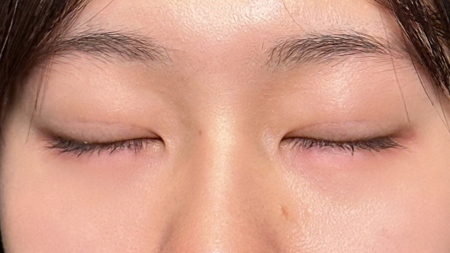 Postoperative Condition Part 1