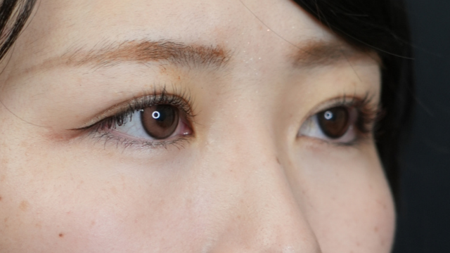 Postoperative Condition Part 1