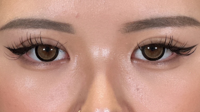 Postoperative Condition Part 1