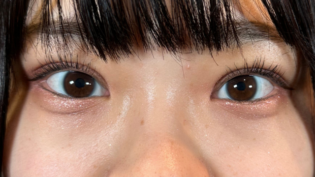 Postoperative Condition Part 1