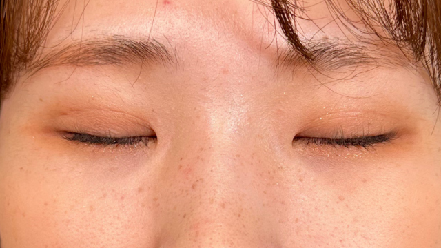 Postoperative Condition Part 1