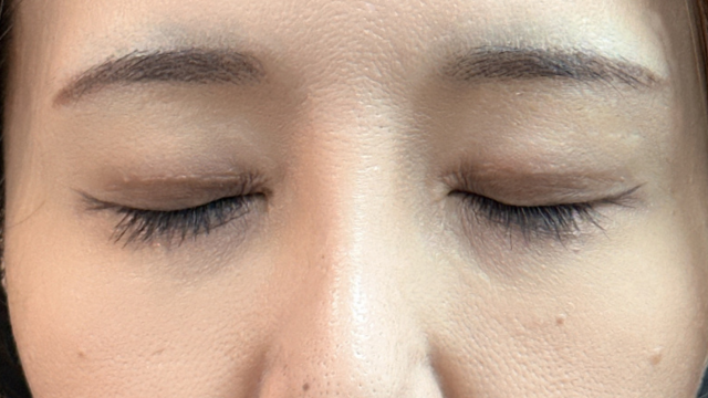 Postoperative Condition Part 1