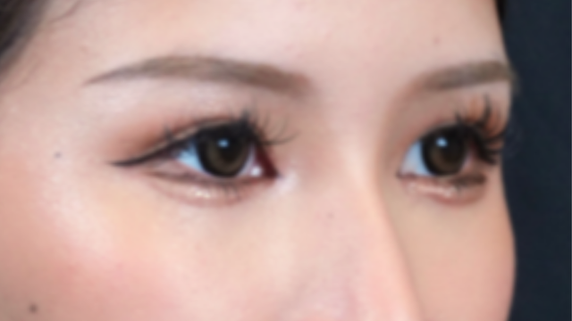 Postoperative Condition Part 1