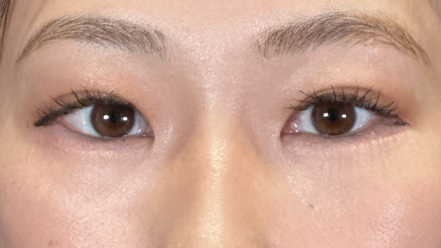 Postoperative Condition Part 1