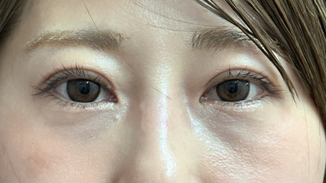 Postoperative Condition Part 1