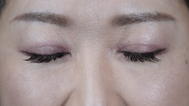 Postoperative Condition Part 1