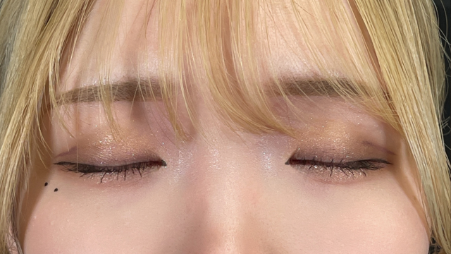 Postoperative Condition Part 1