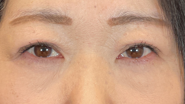 Postoperative Condition Part 1