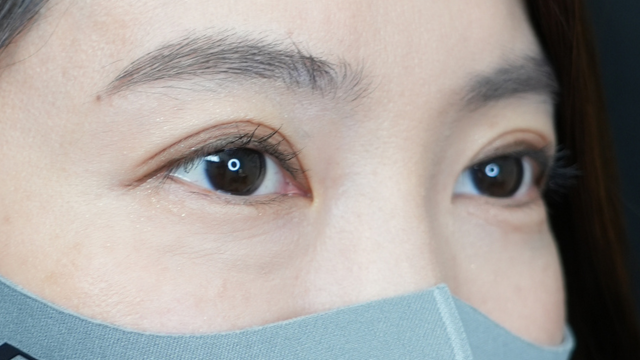 Postoperative Condition Part 1