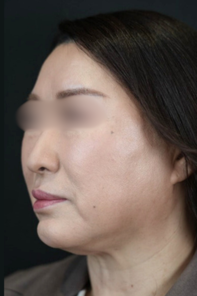 Postoperative Condition Part 1