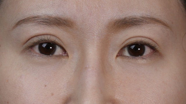 Postoperative Condition Part 1