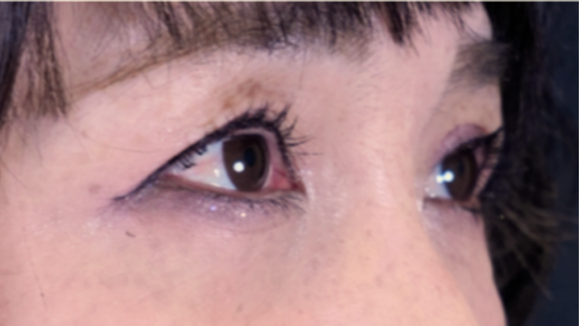 Postoperative Condition Part 1