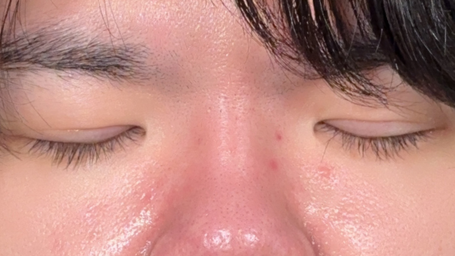 Postoperative Condition Part 1