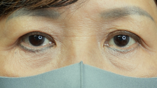 Postoperative Condition Part 1