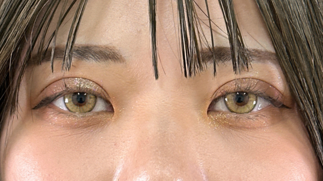 Postoperative Condition Part 1