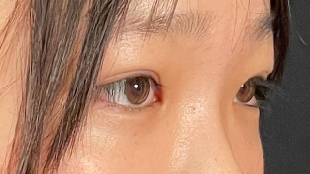 Postoperative Condition Part 1