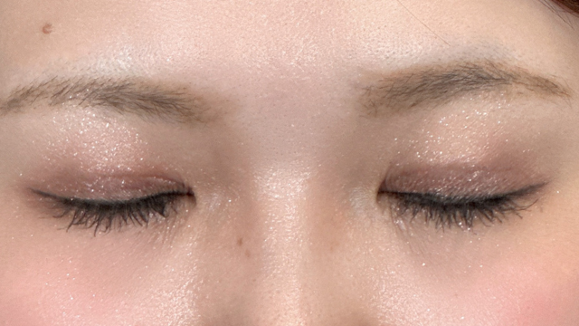 Postoperative Condition Part 1