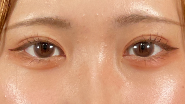 Postoperative Condition Part 1