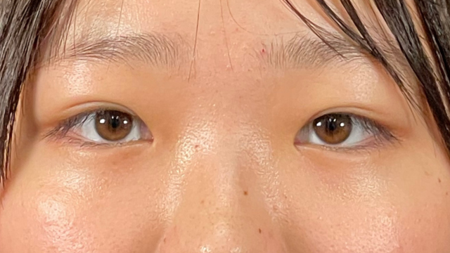 Postoperative Condition Part 1