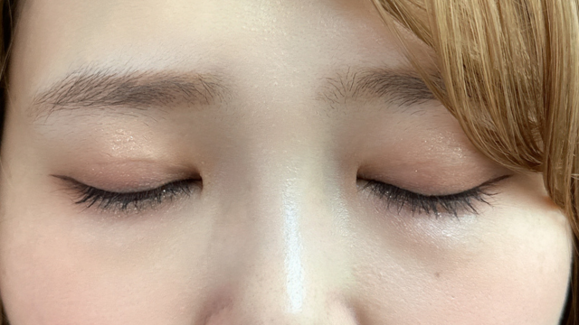 Postoperative Condition Part 1