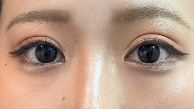 Postoperative Condition Part 1