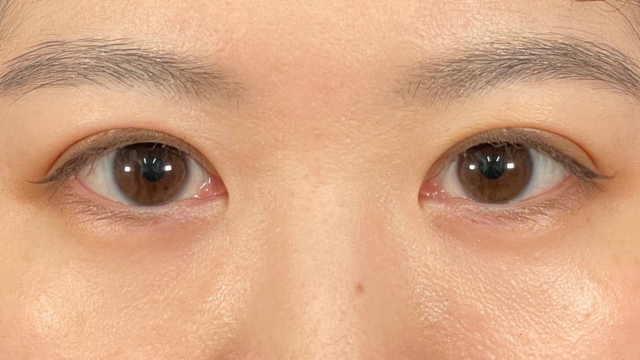 Postoperative Condition Part 1