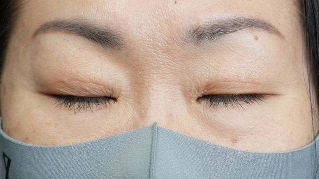 Postoperative Condition Part 1