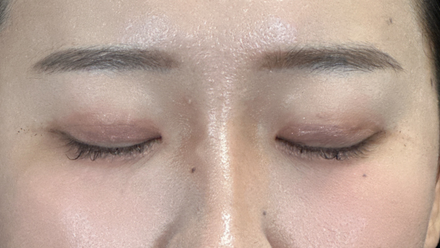 Postoperative Condition Part 1