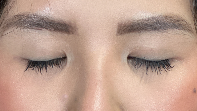 Postoperative Condition Part 1