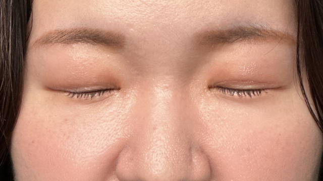 Postoperative Condition Part 1