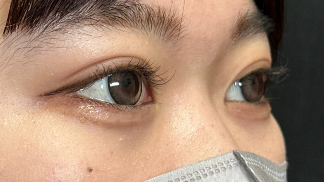 Postoperative Condition Part 1