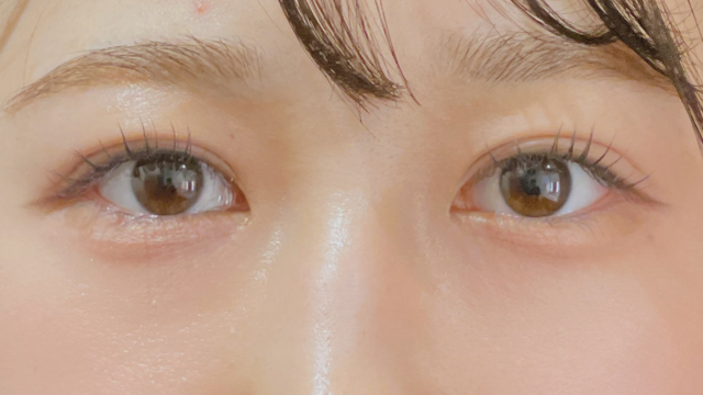 Postoperative Condition Part 1