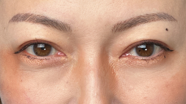 Postoperative Condition Part 1