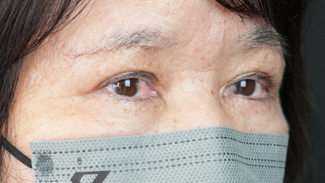 Postoperative Condition Part 1