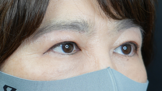 Postoperative Condition Part 1